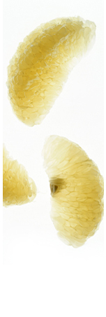 contact universal catering cluj